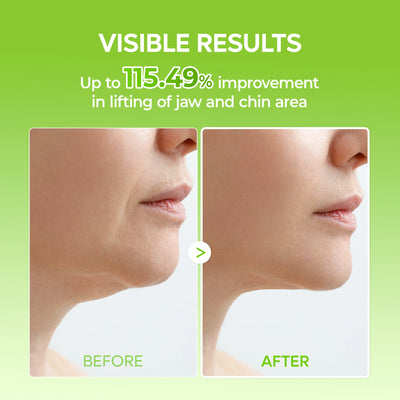 Cactox De-Puffing Pore Tox V-Lifting Set