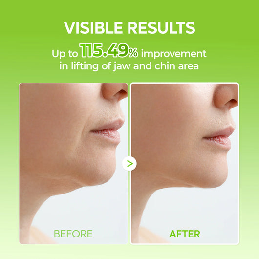 Cactox De-Puffing Pore Tox V-Lifting Set