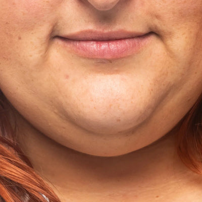 Double Chin in Photos
