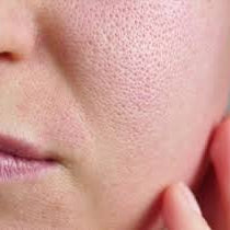 Pores Looking Bigger